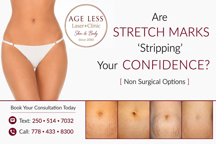 Stretch Mark Removal